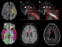 brain imaging studies from Adam Brickman's laboratory at Columbia University